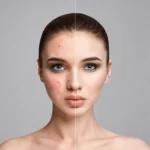 مقایسه ظاهر پوست قبل و بعد از استفاده از صابون گانودرما دست و صورت